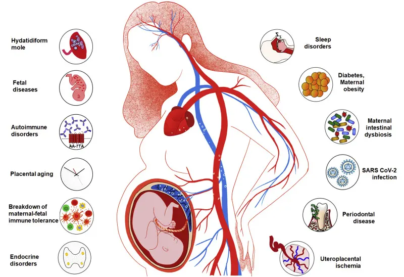 علت پره اکلامپسی فاکتورهای پره اکلامپسی
