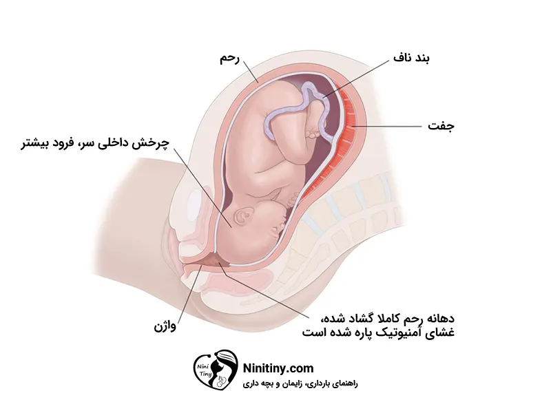 مراحل زایمان طبیعی 2 فاز انتقال از مراحل زایمان طبیعی