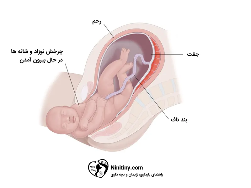 مراحل زایمان طبیعی 5 روند زایمان طبیعی