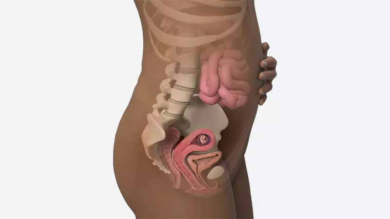 اندازه شکم در هفته دهم بارداری اندازه شکم در هفته دهم بارداری