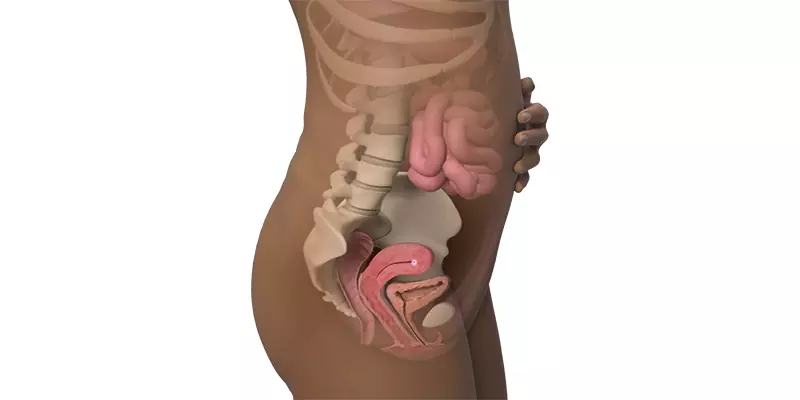 اندازه شکم در هفته سوم بارداری اندازه شکم در هفته سوم بارداری