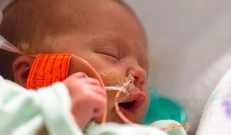 تغذیه نوزاد زودرس در NICU با روش لوله تغذیه تغذیه نوزاد زودرس در NICU با روش لوله تغذیه