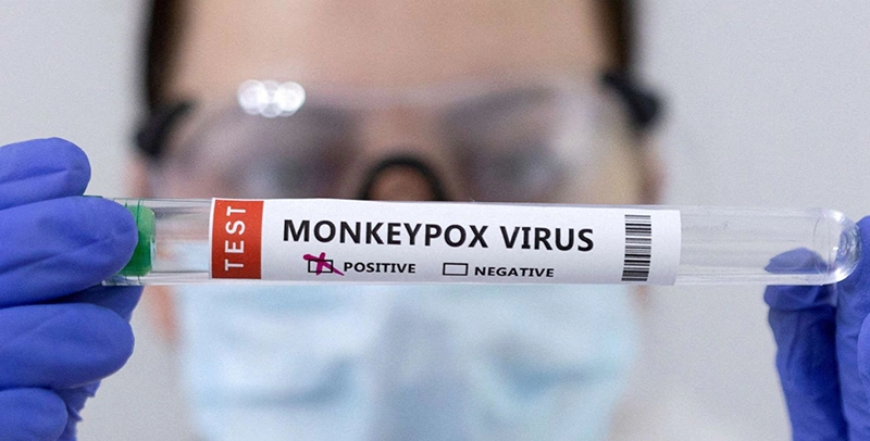 آبله میمونی آبله میمونی در کودکان