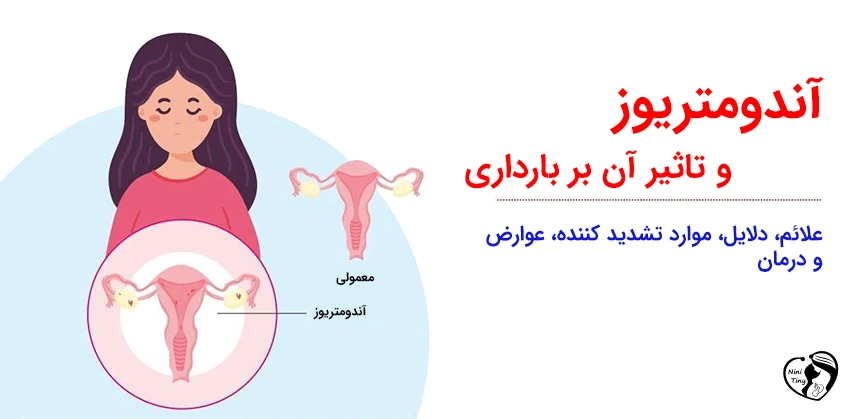 آندومتریوز و تاثیر آن بر بارداری