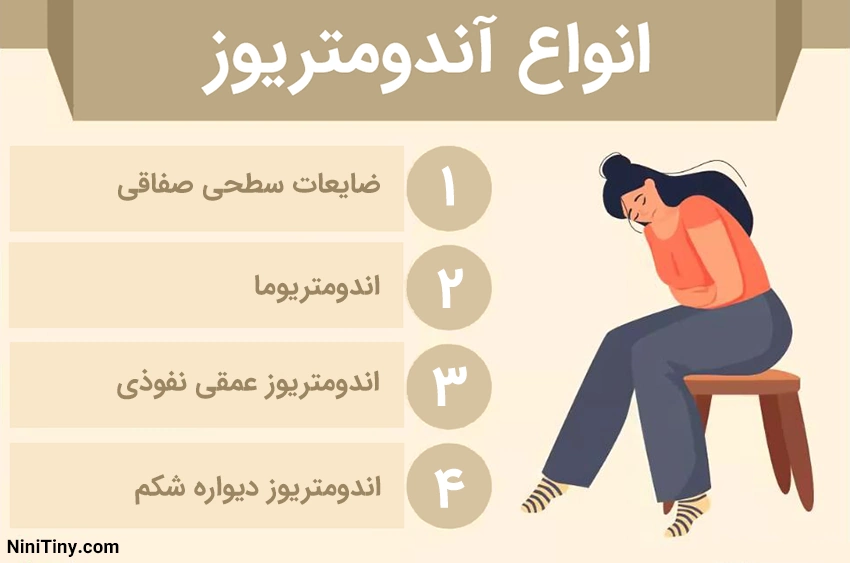 انواع آندومتریوز انواع آندومتریوز