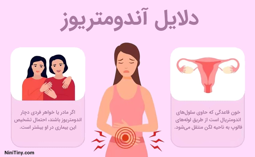 دلایل آندومتریوز دلایل آندومتریوز