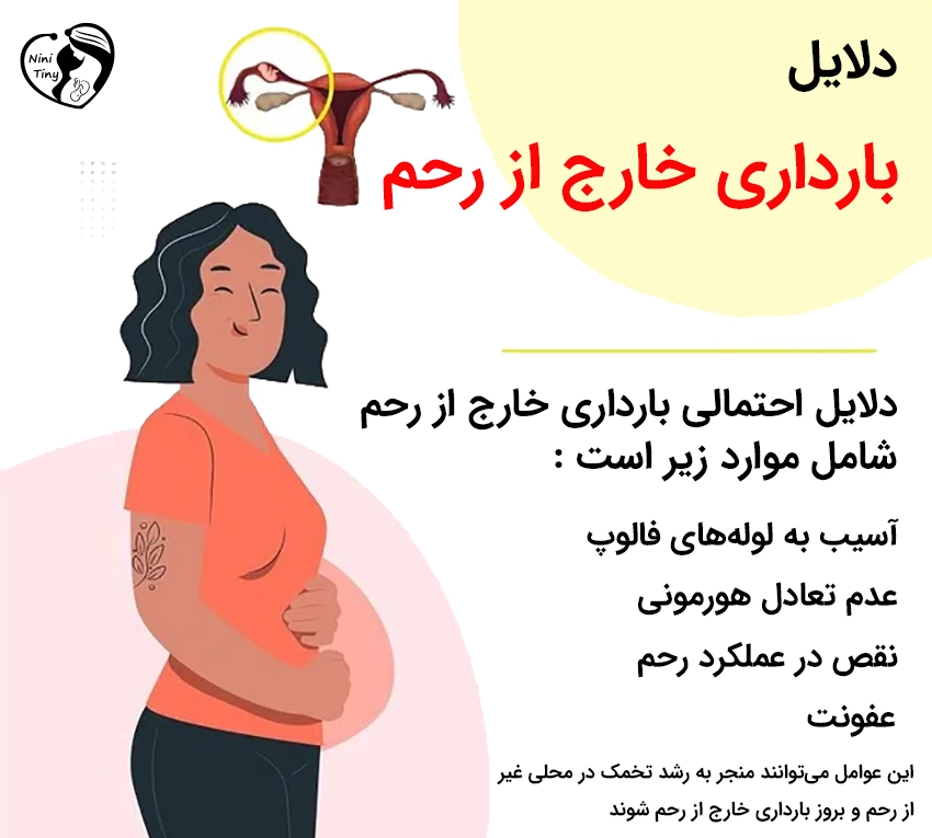 دلایل بارداری خارج از رحم دلایل بارداری خارج از رحم