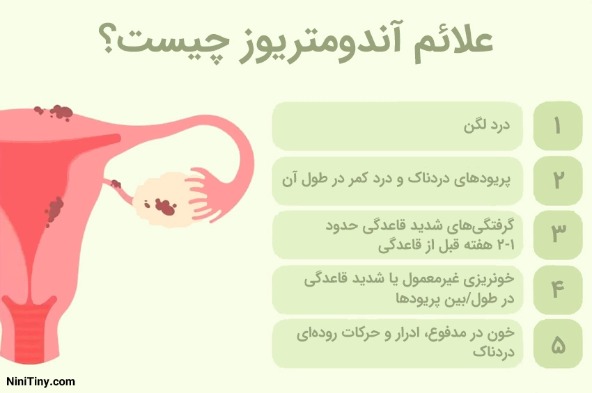 علائم آندومتریوز علائم آندومتریوز