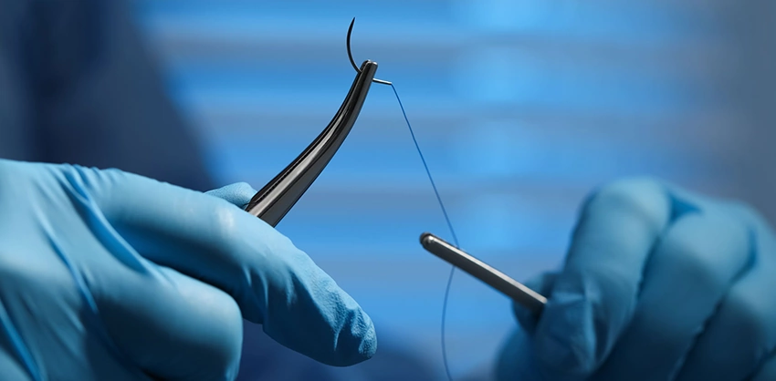 Perineal Tear Claims درمان پارگی پرینه