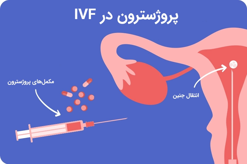 Progesterone during IVF پروژسترون در IVF