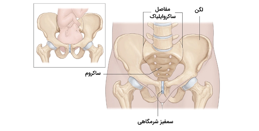 انواع درد لگن در بارداری