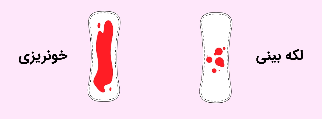 bleeding spotting pregnancy تفاوت لکه بینی و خونریزی در بارداری چیست؟