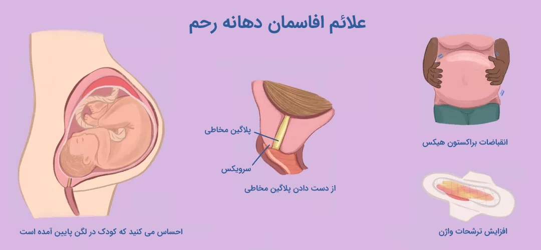 sign of cervical effacement علائم افاسمان دهانه رحم