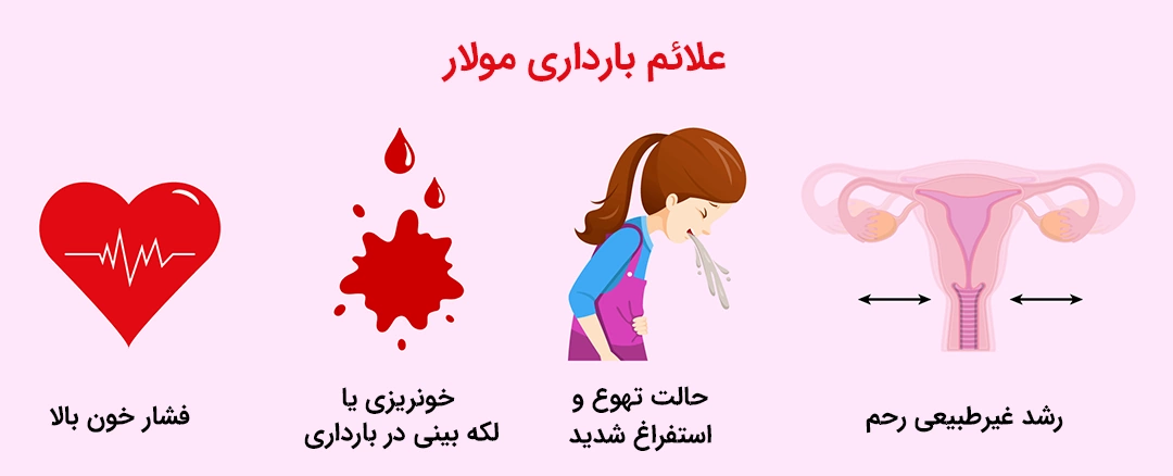 symptoms molar pregnancy علائم بارداری مولار
