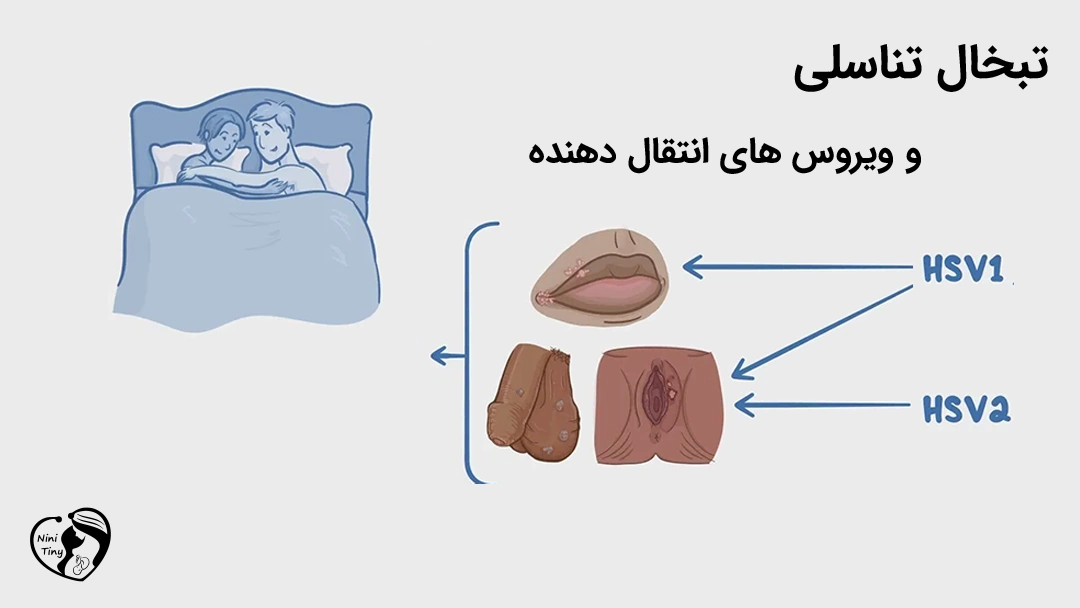 Genital herpes and its transmitting viruses تبخال تناسلی و ویروس های انتقال دهنده آن