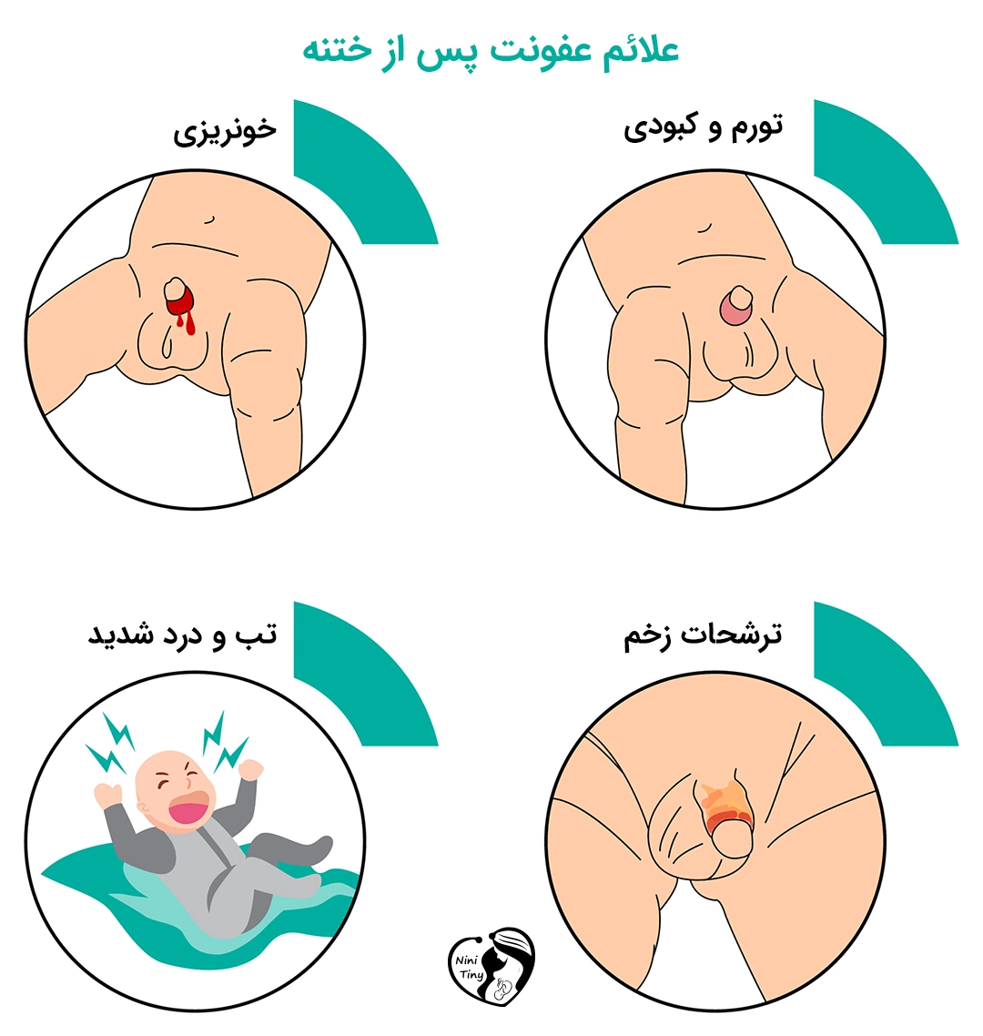 symptom of Circumcision Infection علائم عفونت پس از ختنه