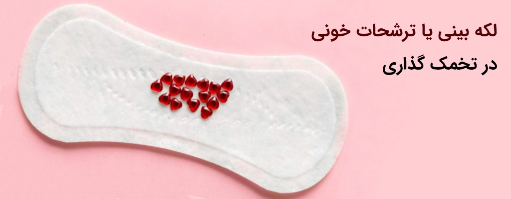 Light spotting or discharge in ovulation لکه بینی یا ترشحات خونی در تخمک گذاری