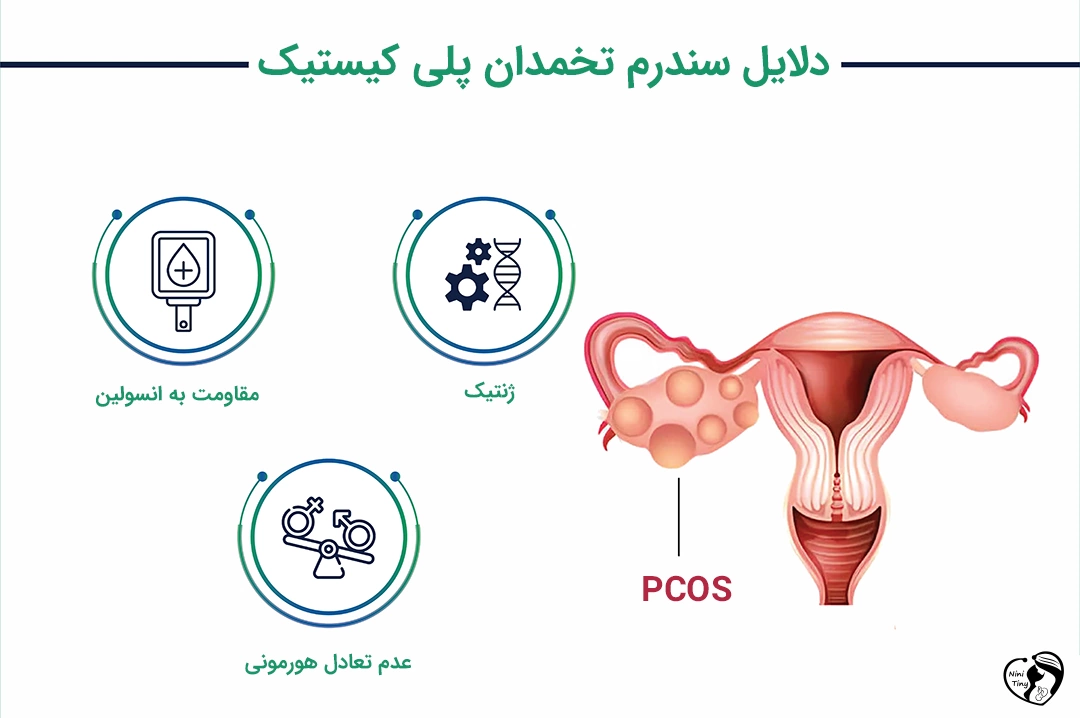 دلایل سندرم تخمدان پلی کیستیک