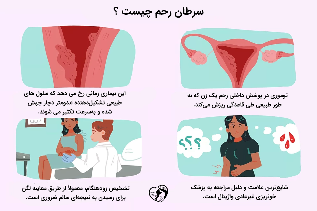 سرطان رحم چیست؟