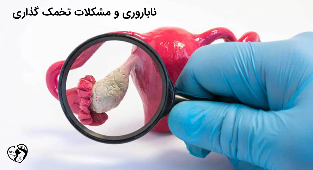 Infertility and ovulation problems ناباروری و مشکلات تخمک گذاری