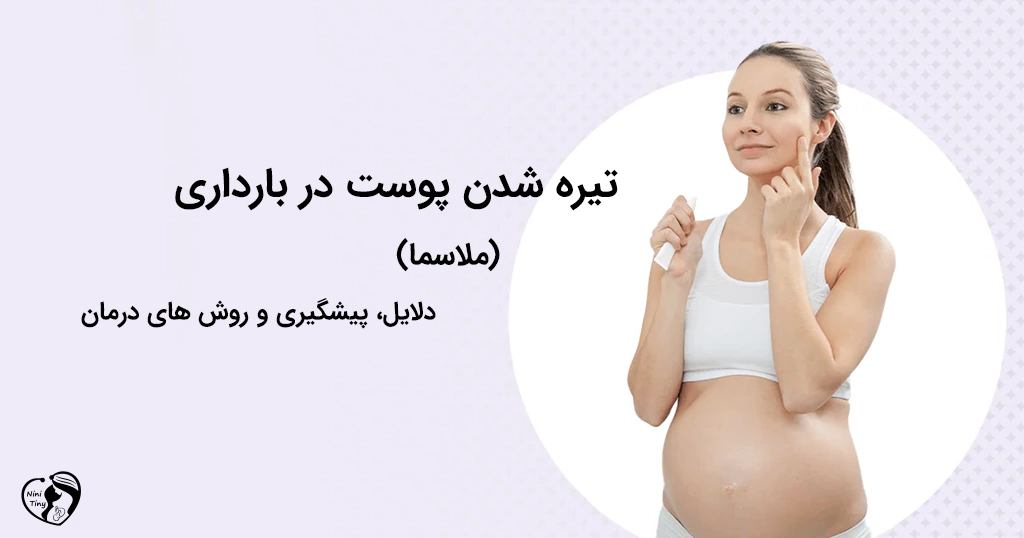 تیره شدن پوست در بارداری - ملاسما 