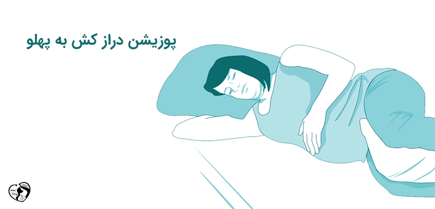 labor Lying on your side position پوزیشن زایمان درازکش به پهلو