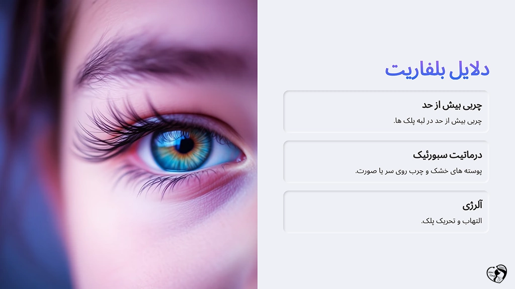 Causes of blepharitis in children دلایل ابتلا به بلفاریت در کودکان