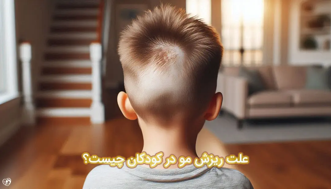 ریزش مو در کودکان ریزش مو در کودکان
