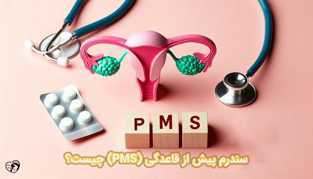 سندرم پیش از قاعدگی (pms) سندرم پیش از قاعدگی (PMS)