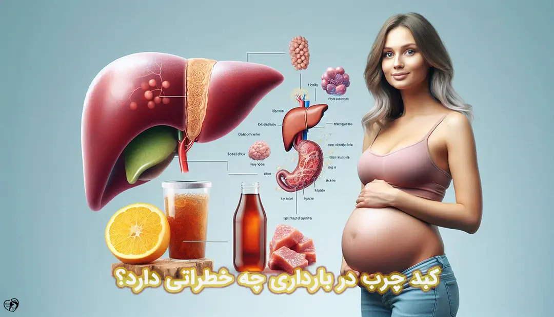 کبد چرب در بارداری کبد چرب در بارداری