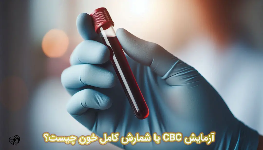 آزمایش CBC آزمایش CBC