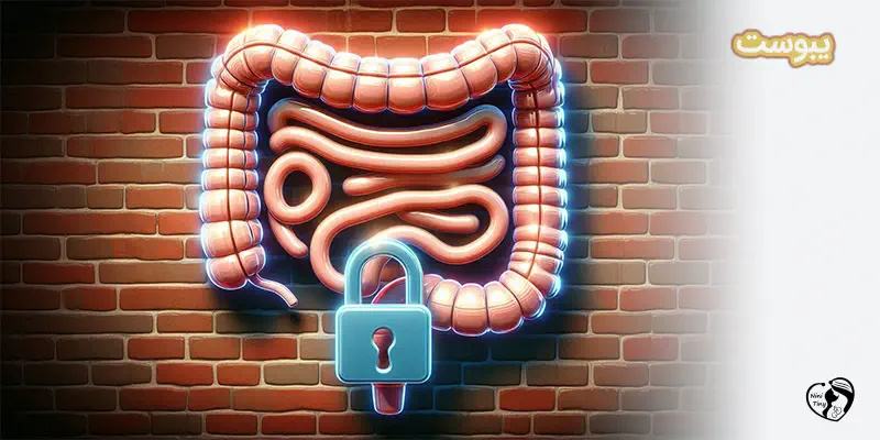 یبوست چیست؟