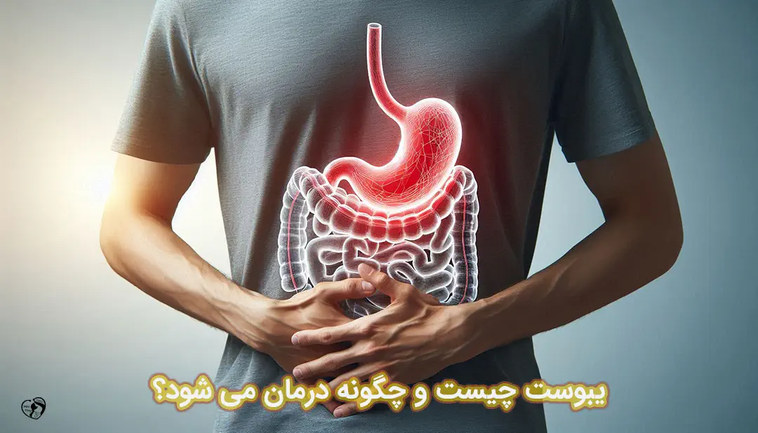 یبوست یبوست