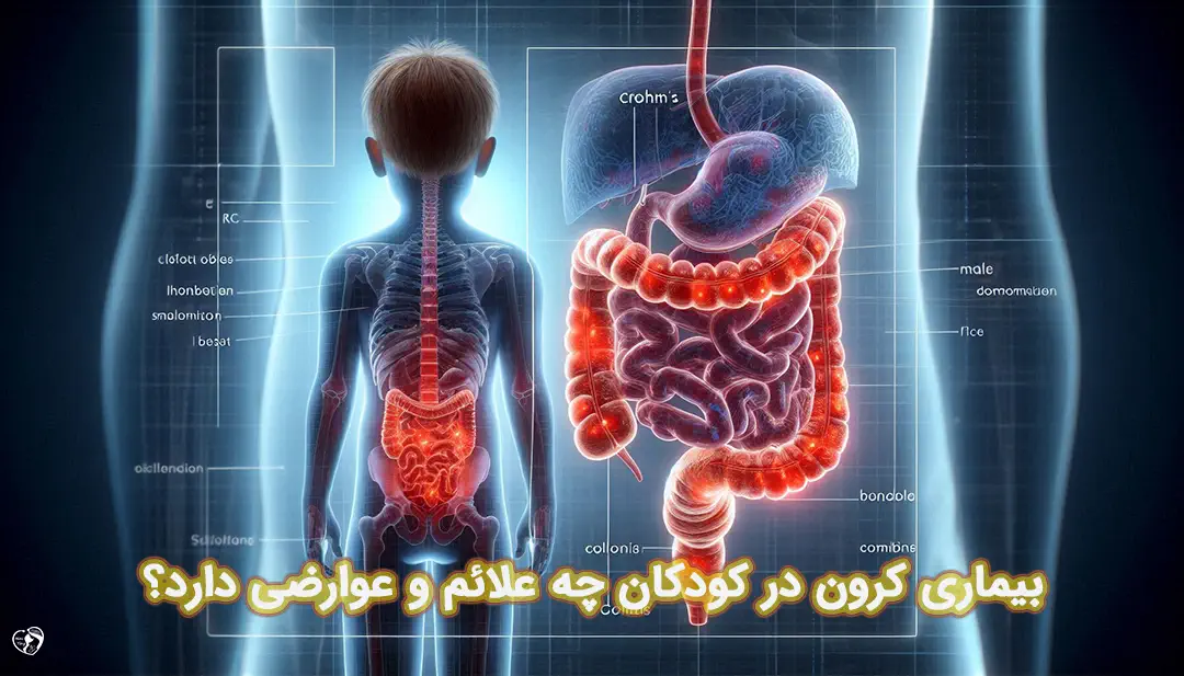 کرون در کودکان کرون در کودکان