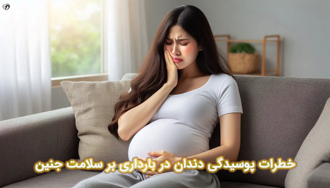 پوسیدگی دندان در بارداری پوسیدگی دندان در بارداری