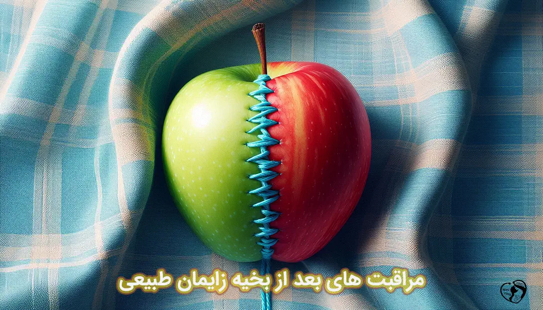 مراقبت از بخیه زایمان طبیعی مراقبت از بخیه زایمان طبیعی