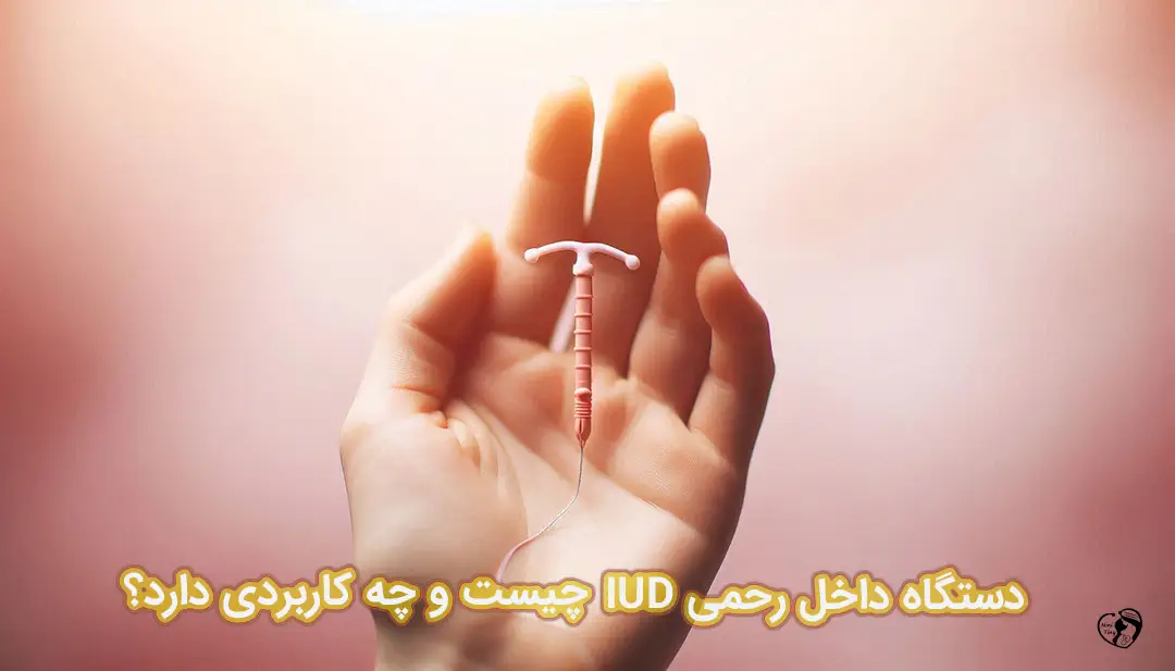 دستگاه داخل رحمی IUD 