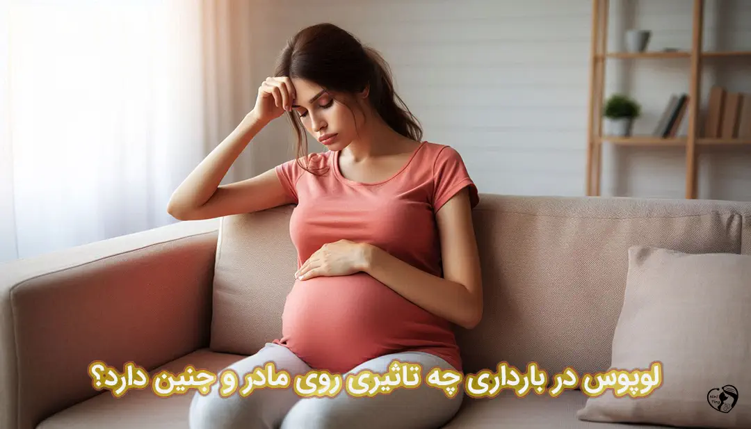 لوپوس در بارداری لوپوس در بارداری