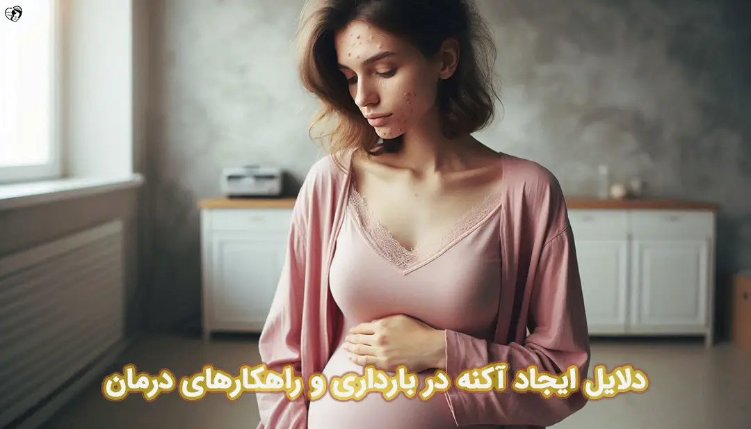 آکنه در بارداری آکنه در بارداری