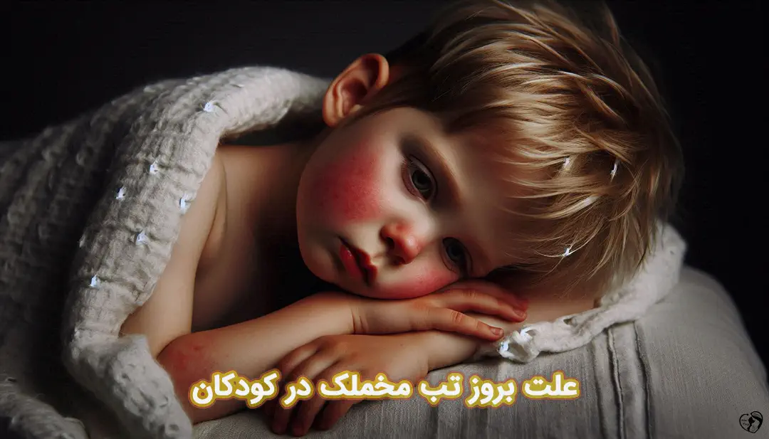 تب مخملک در کودکان