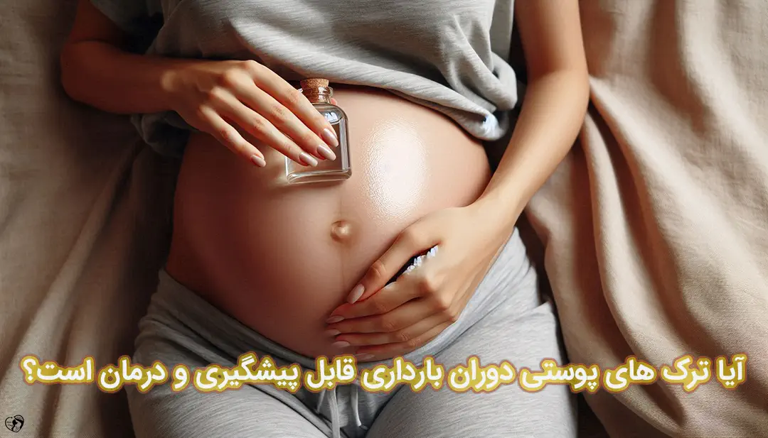 ترک های پوستی در بارداری ترک های پوستی در بارداری