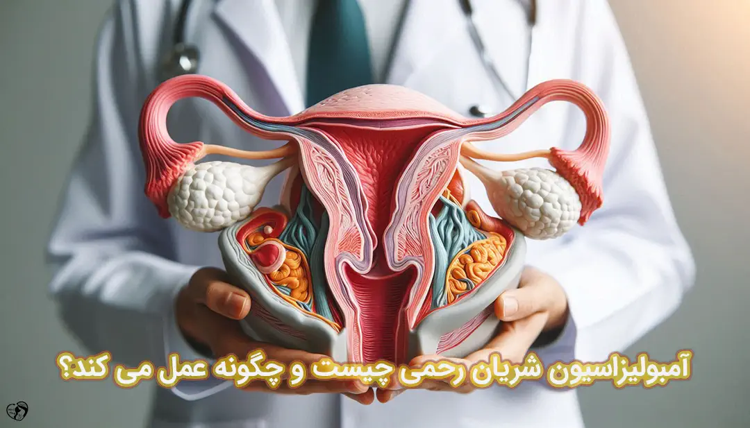 آمبولیزاسیون شریان رحمی آمبولیزاسیون شریان رحمی