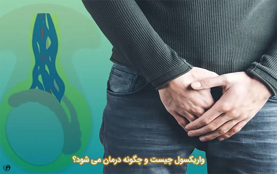 واریکسول