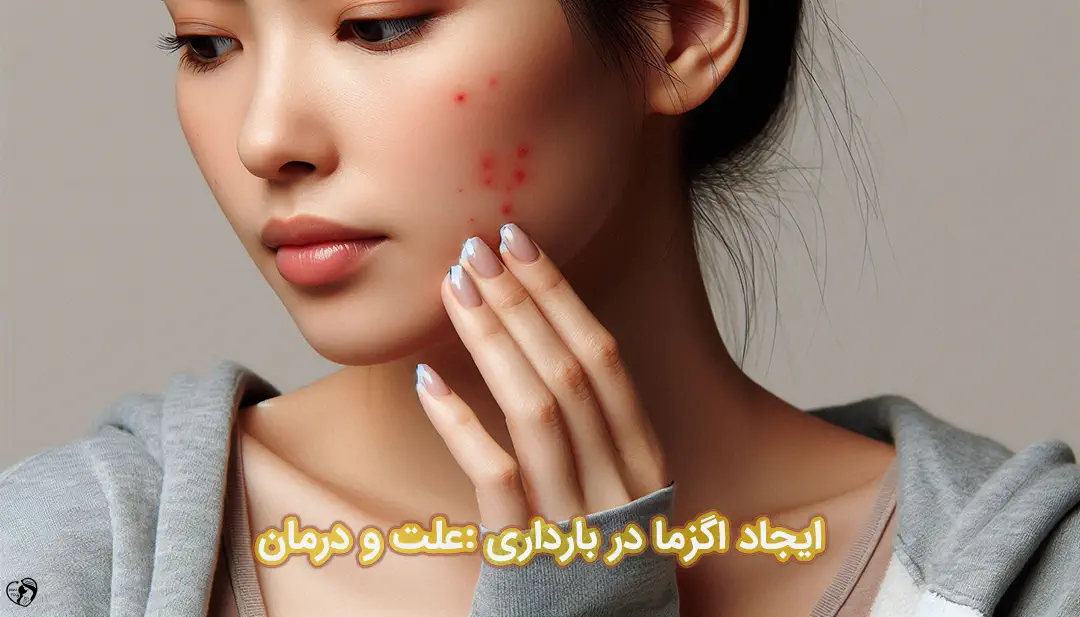اگزما در بارداری اگزما در بارداری