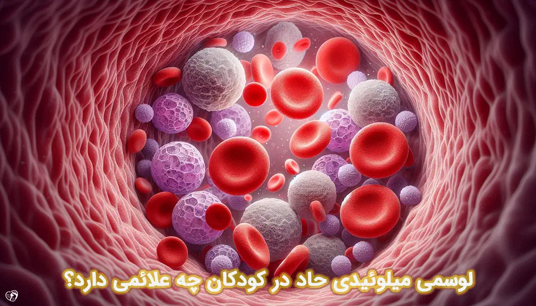 لوسمی میلوئیدی حاد در کودکان