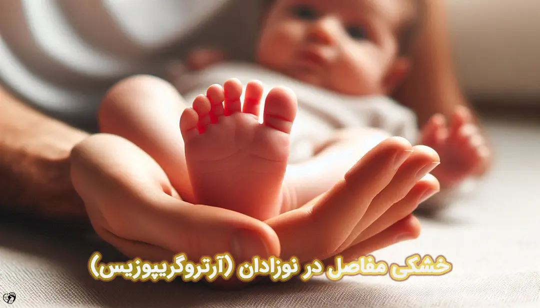 خشکی مفاصل در نوزادان خشکی مفاصل در نوزادان