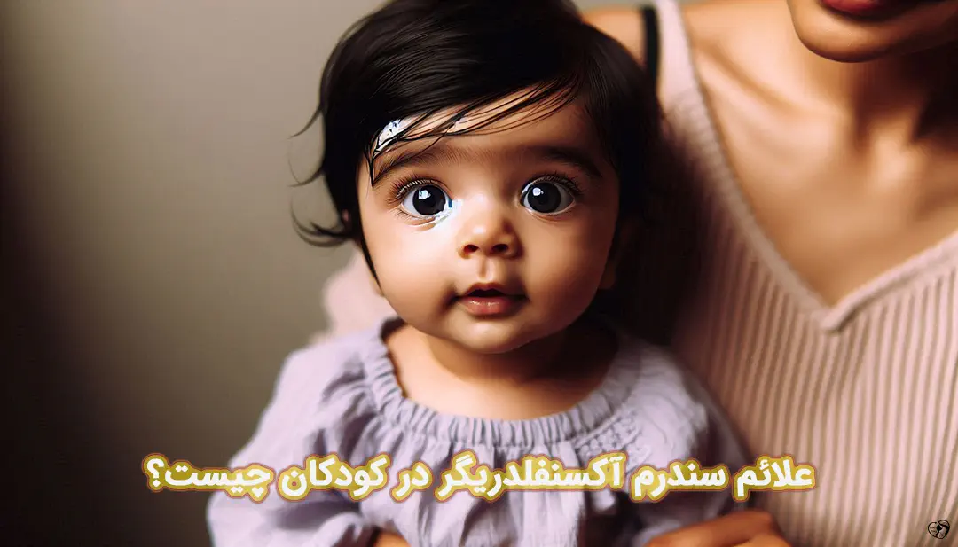 سندرم آکسنفلدریگر در کودکان