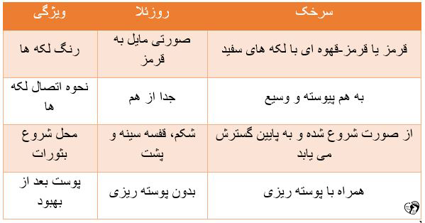 روزئلا در کودکان