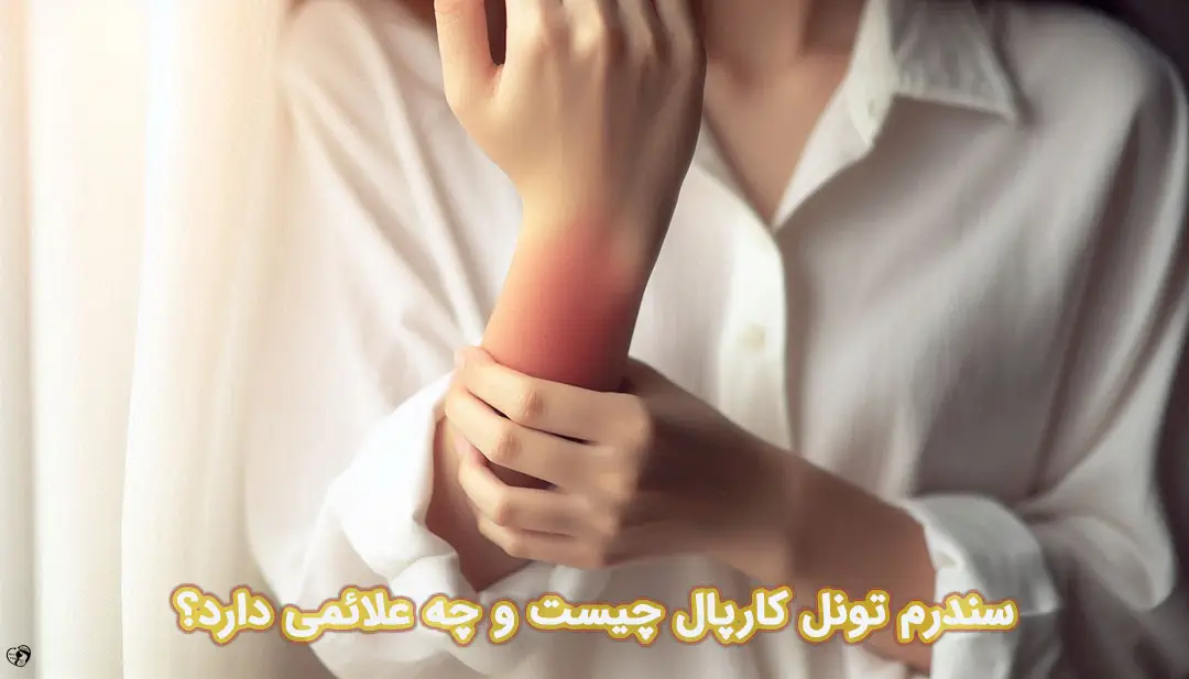 سندرم تونل کارپال سندرم تونل کارپال
