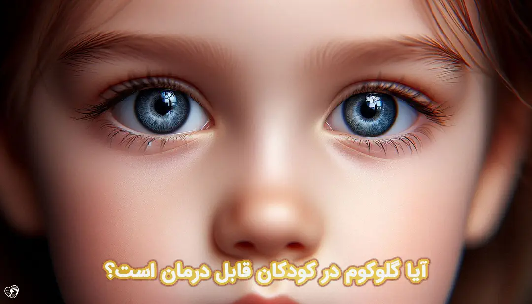 گلوکوم در کودکان